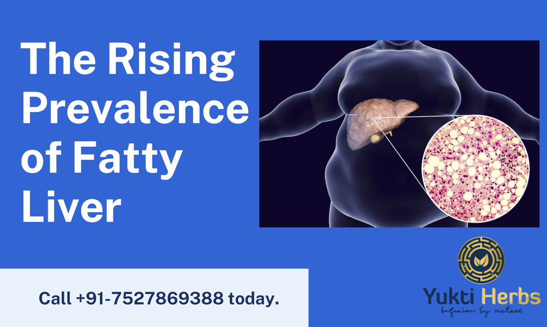 The Rising Prevalence of Fatty Liver - Yukti Herbs